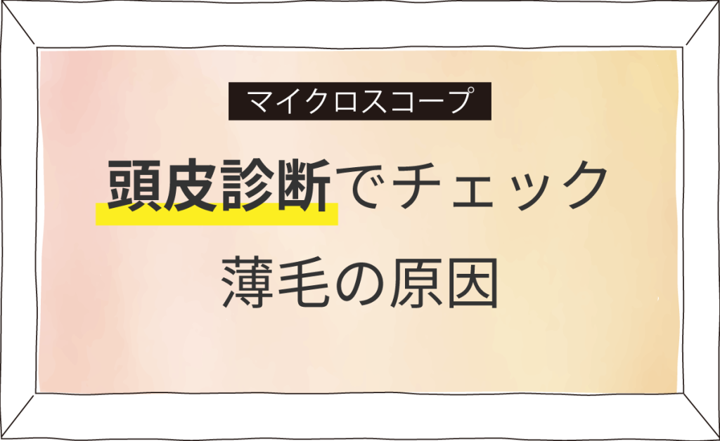 頭皮診断で髪の悩みを解決する方法