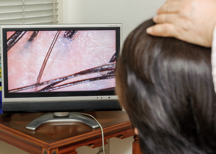 マイクロスコープて診断