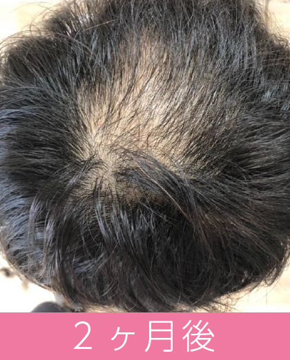2ヶ月後
