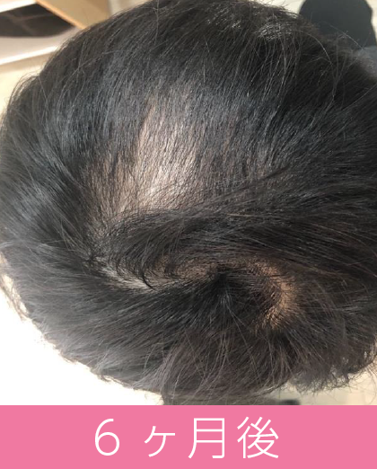 6ヶ月後