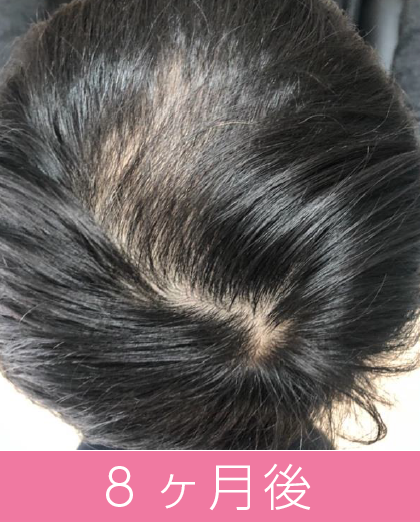 8ヶ月後
