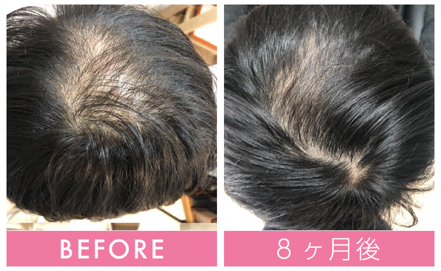 ビフォア・アフター