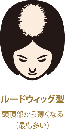 ルードウィッグ型
