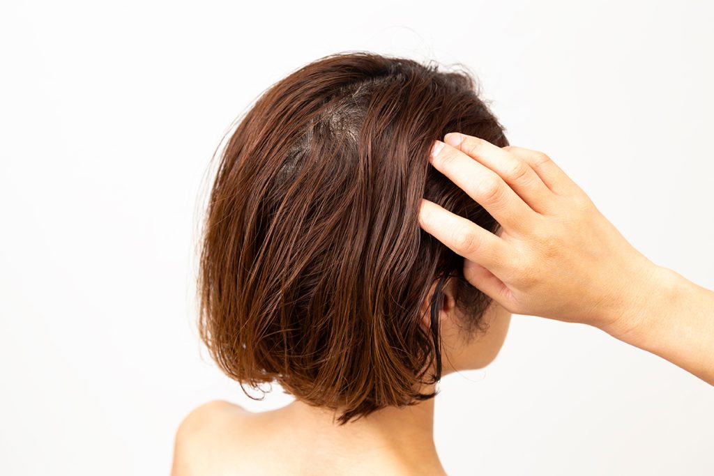 頭皮のトラブルとヘアスタイルの影響