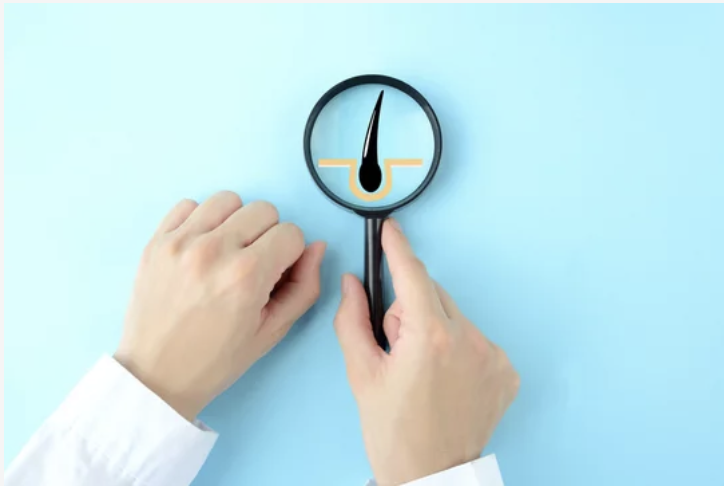 抜け毛は早期対策が重要