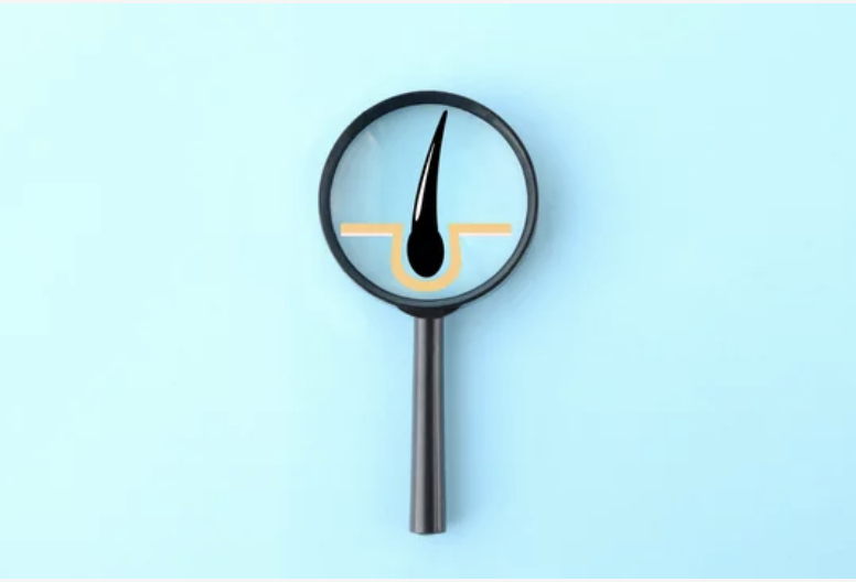 マイクロスコープ頭皮診断