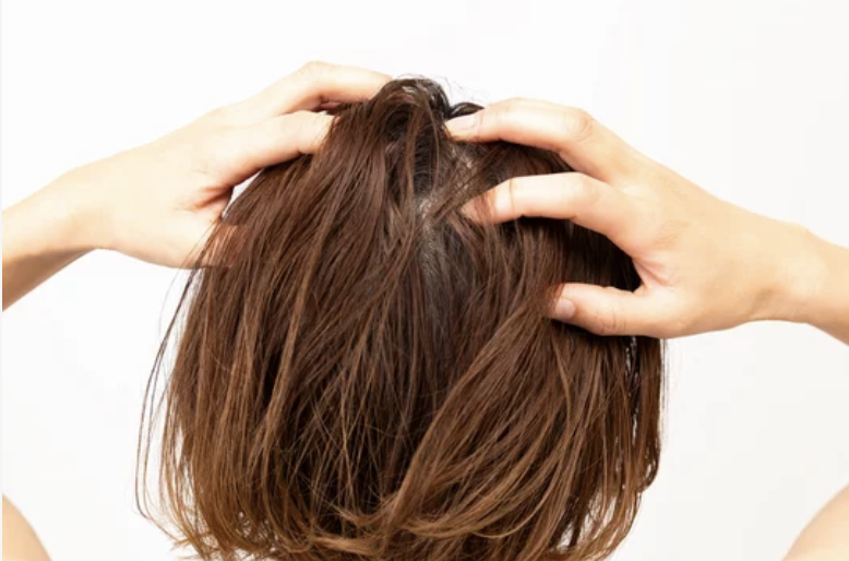 頭皮環境の悪化