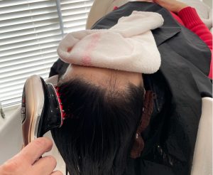 EMS LEDポレーション