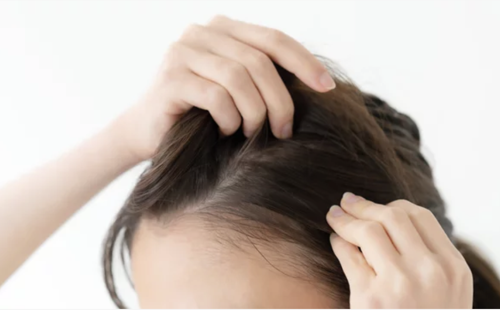 薄毛改善を目指す!女性におすすめ美容室とヘアスタイル